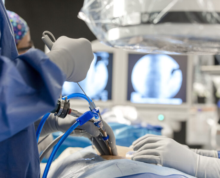 Endoscopic-Surgery-scaled