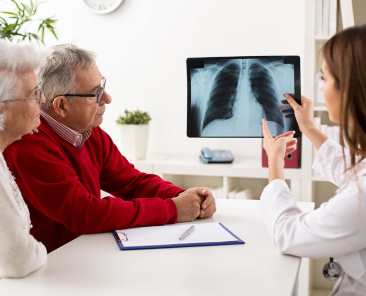 Doctor shows results to old patient x-ray of the lungs, smoking cigarettes problem